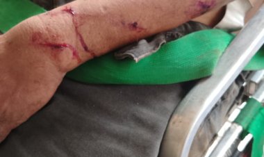 Tragis, Pria 67 Tahun Bernama Sudirman Dianiaya di Agam