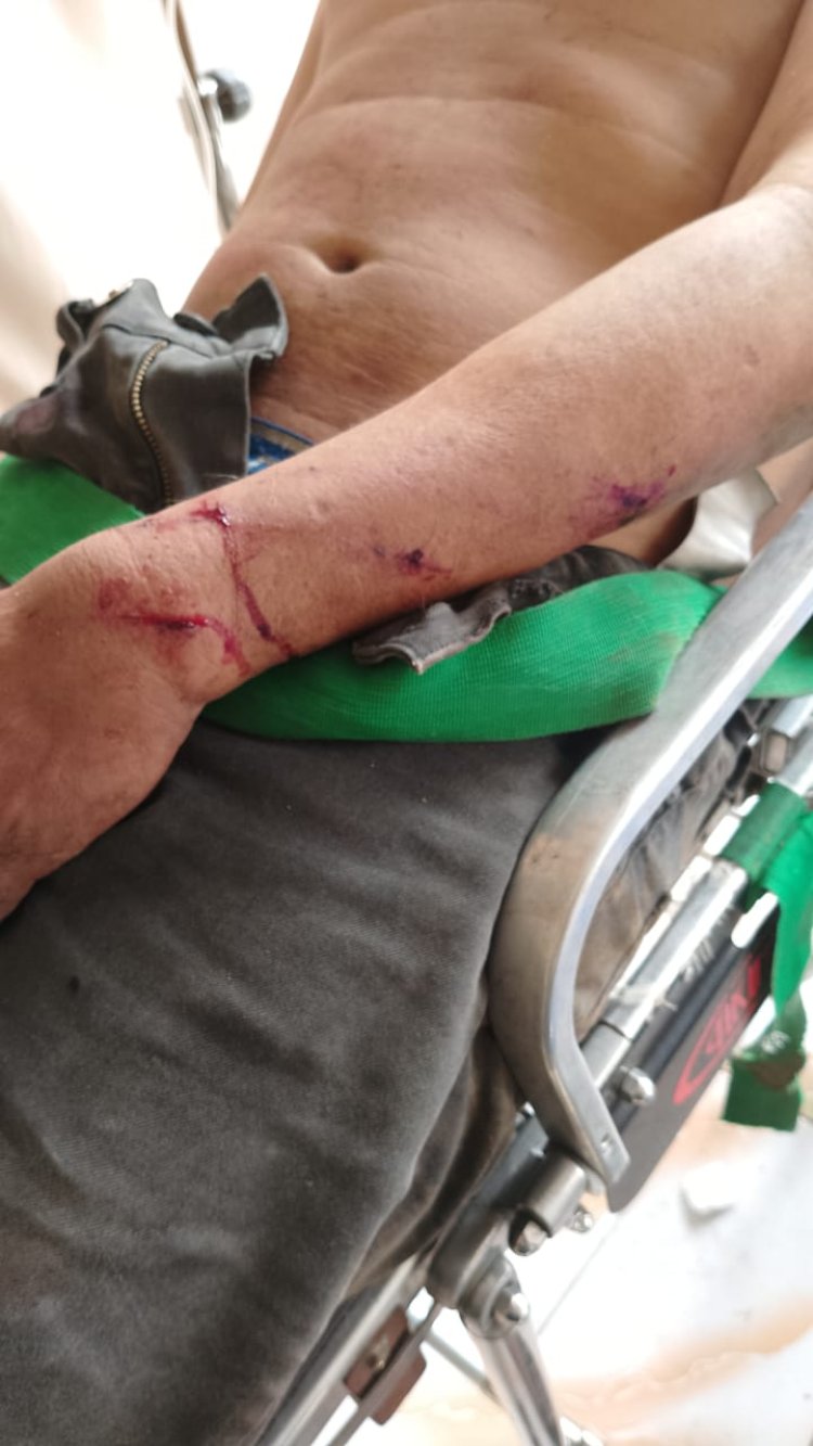 Tragis, Pria 67 Tahun Bernama Sudirman Dianiaya di Agam