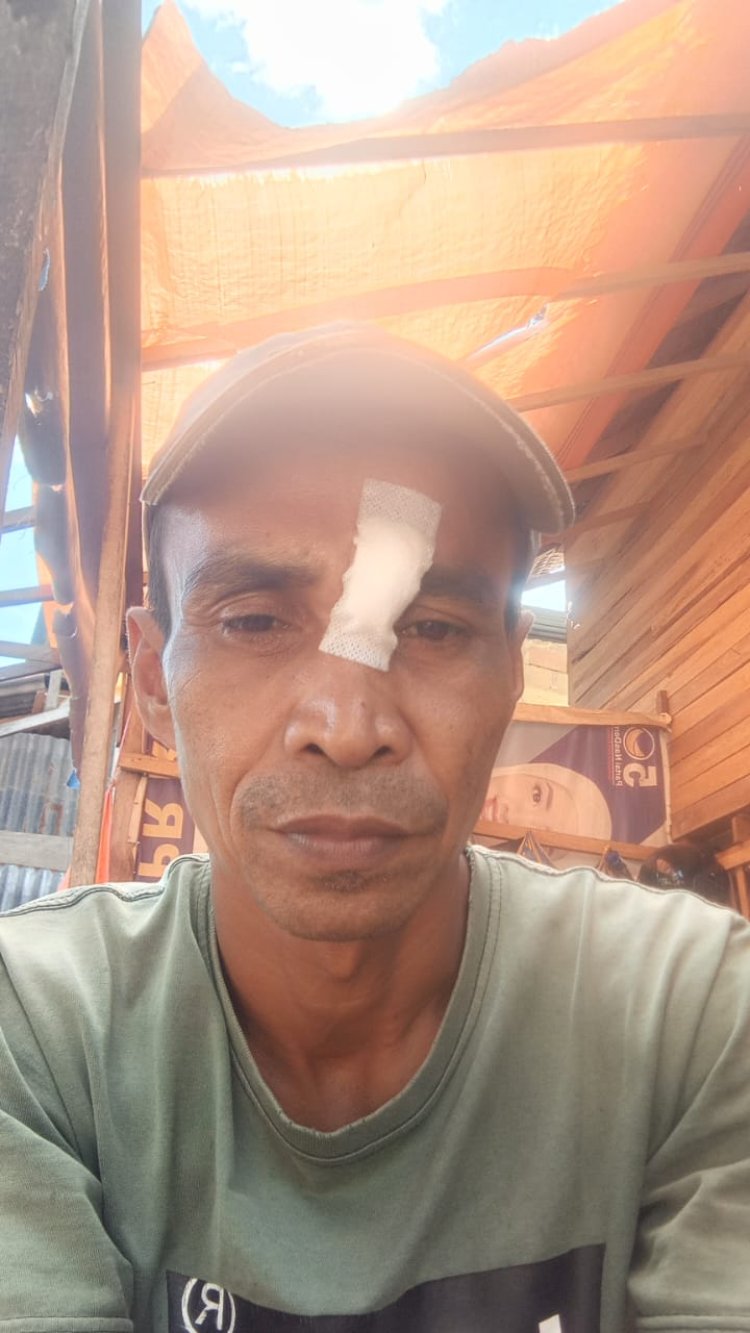 Warga Talang Maur Dihajar Gegara Cemburu Buta